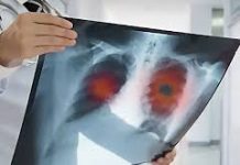 ΓΝ – ΚΥ Κω «ΙΠΠΟΚΡΑΤΕΙΟΝ»: Έναρξη Τακτικών Εξωτερικών Ιατρείων Πνευμονολογίας από Στρατιωτικό Ιατρό