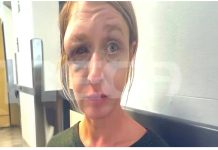 Σοκάρει η εικόνα της 40χρονης που ξυλοκοπήθηκε στο Κορωπί – «Δεν πιστεύω ότι μου επιτέθηκε ο σύντροφός μου, μπορεί οι γείτονες» λέει