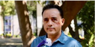 Καρχαρίας δάγκωσε στο κεφάλι βιολόγο και τον άφησε να φύγει: «Ελπίζω να τον ξανασυναντήσω»