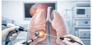 Σύγχρονες Χειρουργικές Τεχνικές στην Αντιμετώπιση του Καρκίνου του Πνεύμονα